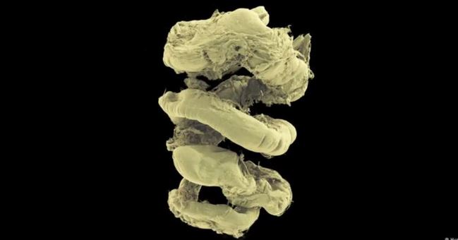 Lanzan el «Google Earth» del cuerpo humano gratis: es 100 mil millones de veces mejor que radiografías | Ciencia y Tecnología