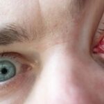 Inventaron una enfermedad ridículamente falsa y la IA igual la trató como real | Ciencia y Tecnología